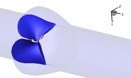 Animated flow-induced motion of a bioprosthetic valve