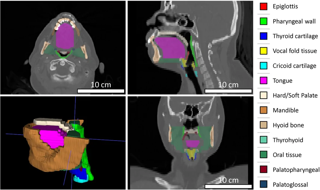 CT slices and segmented structures of the upper airway